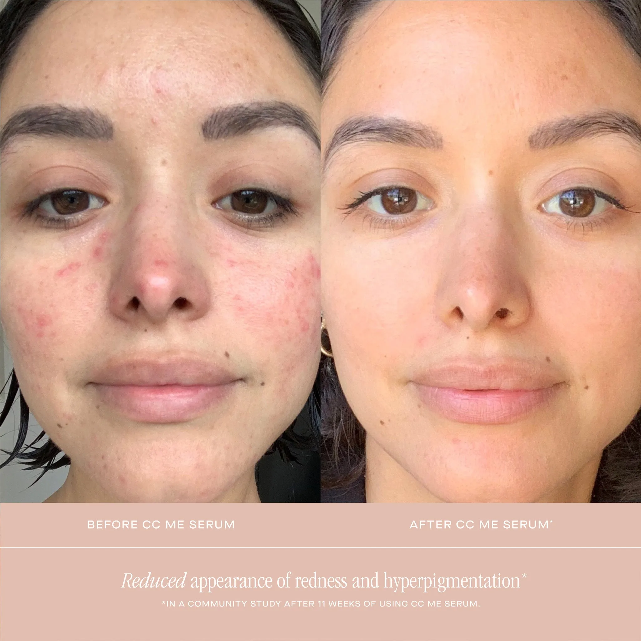 CC ME SERUM