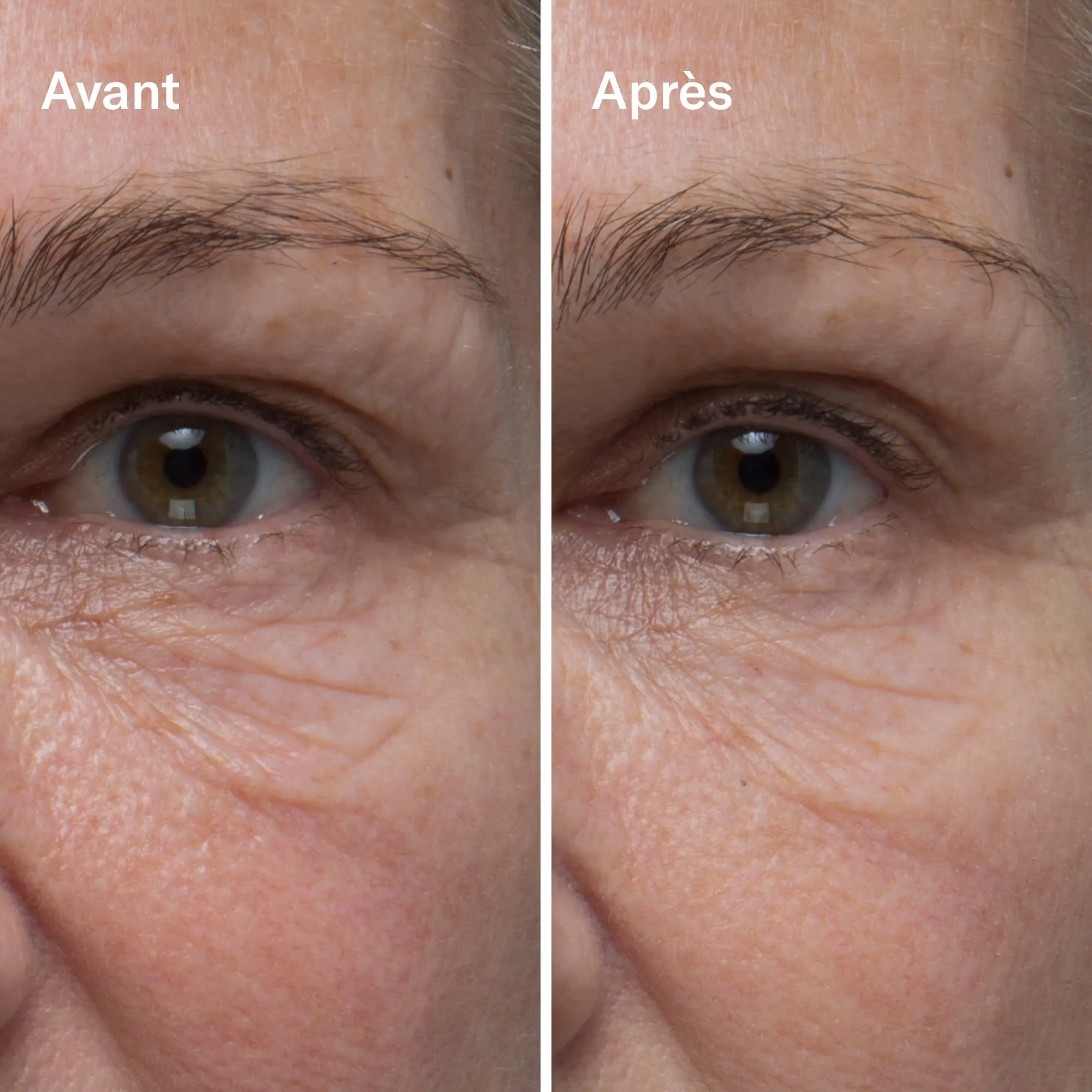 Clean-ical Renewing Serum Sérum Rénovant