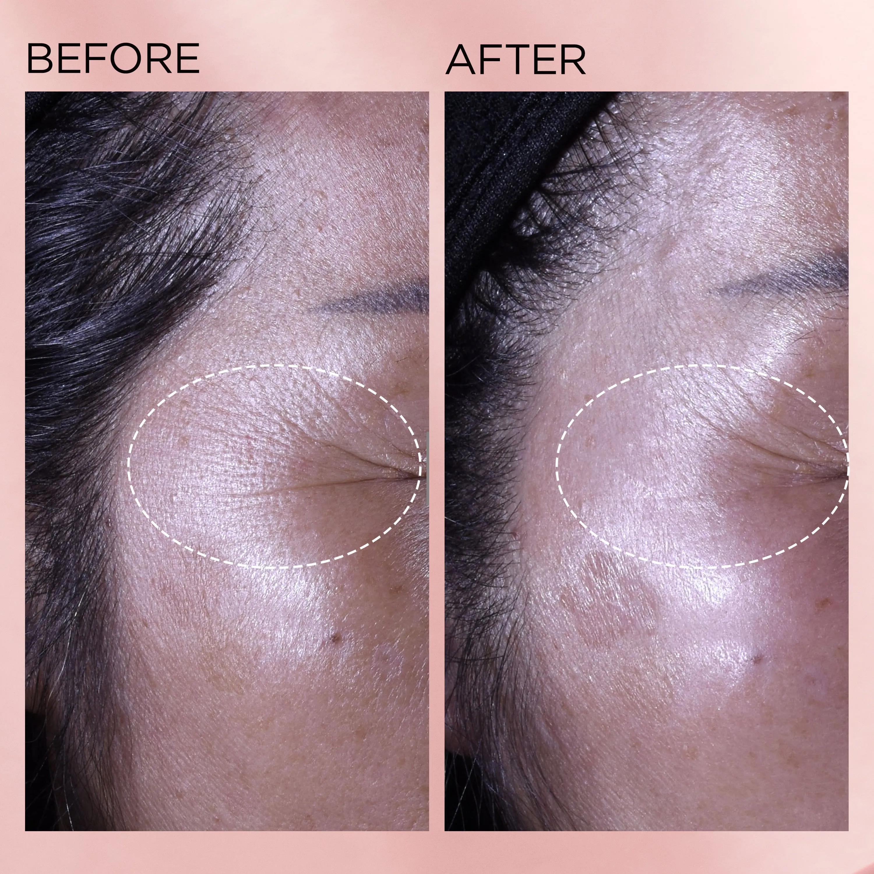 Retinol   HPR Ceramide Capsules Rapid Skin-Renewing Serum
