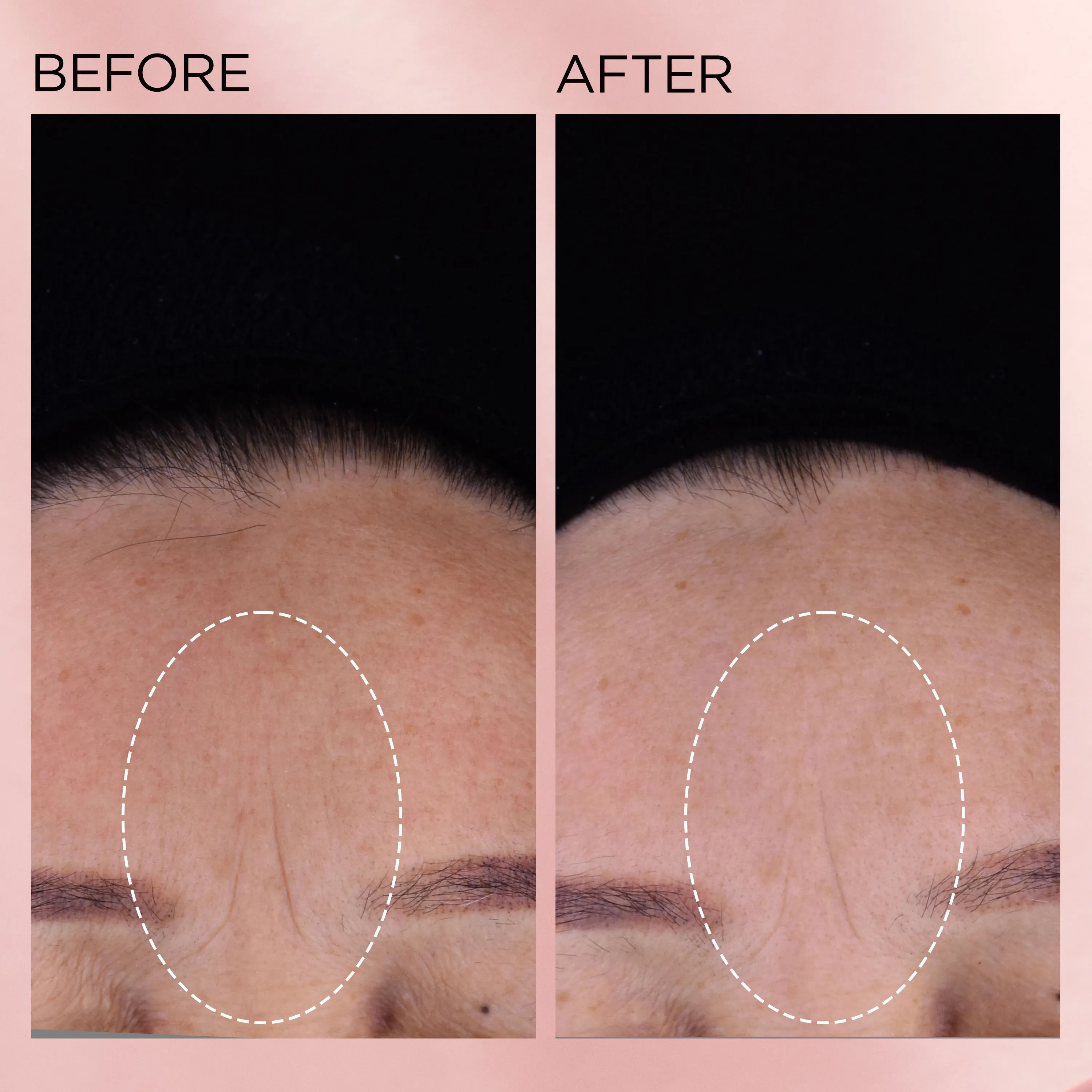 Retinol   HPR Ceramide Capsules Rapid Skin-Renewing Serum