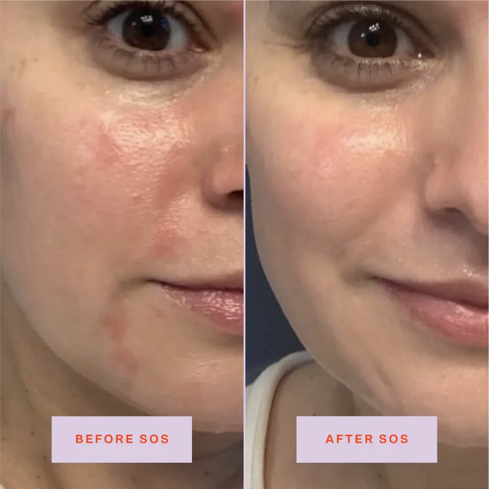 Tower 28 SOS Rescue Facial Spray