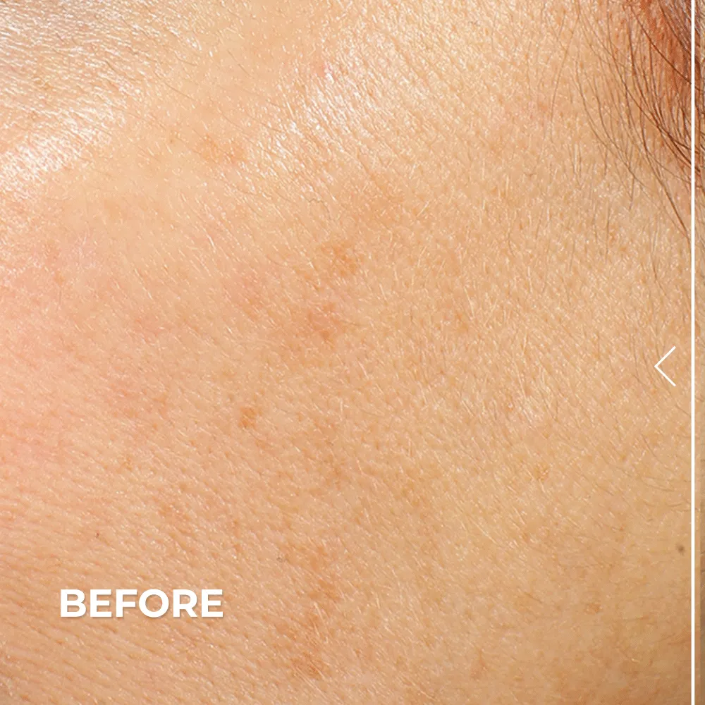 Vitamin C Bright Start Set